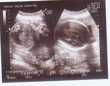 28weeks.jpg