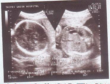 31weeks.jpg