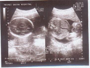 25weeks.jpg