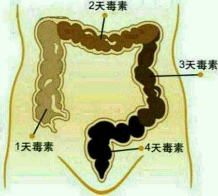 如何保持腸中無宿便