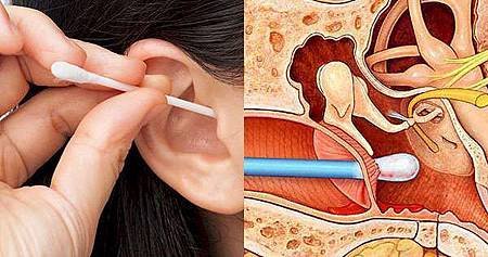 科學證實：你必須停止使用「棉花棒」掏耳朵！