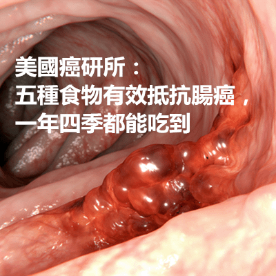 美國癌研所：五種食物有效抵抗腸癌，一年四季都能吃到.png