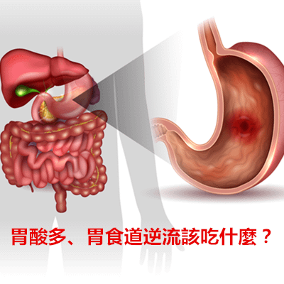 胃酸多、胃食道逆流該吃什麼？.png