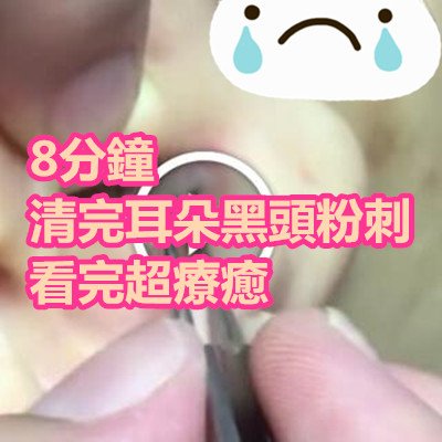 8分鐘清完耳朵黑頭粉刺　看完超療癒.jpg