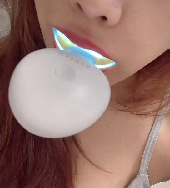 美牙儀真的可以美白嗎有用嗎？ 冷光牙齒美白儀唯愛美牙儀via