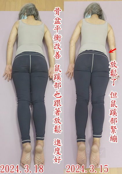 2024.3.4月脊椎平衡瘦身明顯分享