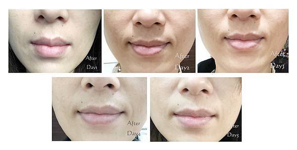 Day1-Day5-1.jpg