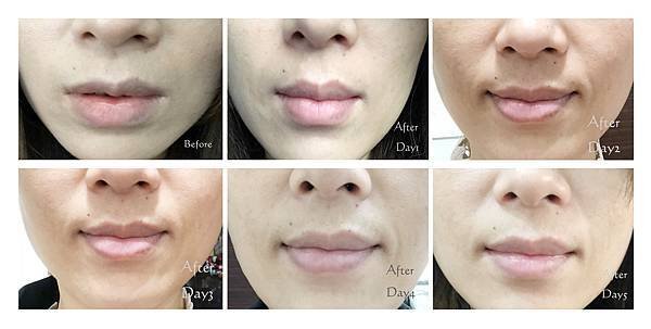 Before-Day5-1.jpg