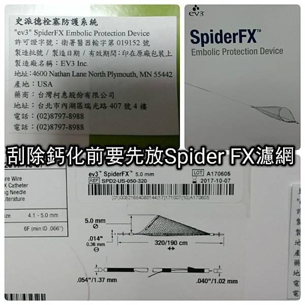 SpiderFX™刮除血管內鈣化組織 (29).jpg