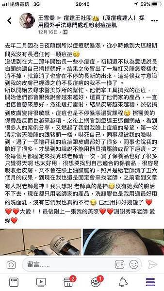 【痘痘粉刺成功之喬喬正妹】美女日夜顛倒所以痘痘就暴長