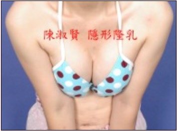 擠乳溝