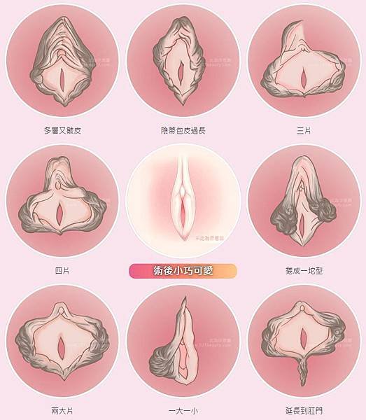 labia-surgeon-1-170724.jpg