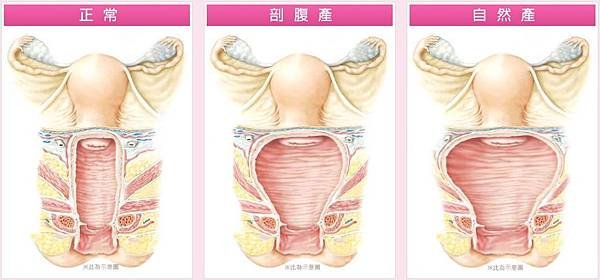 陰道比較.JPG