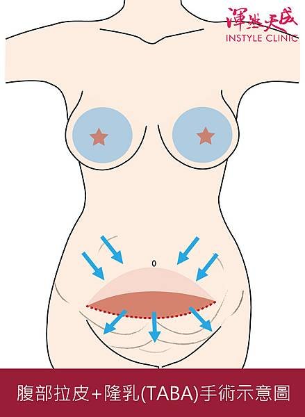 腹拉+隆乳手卡-手繪版-輸出.jpg