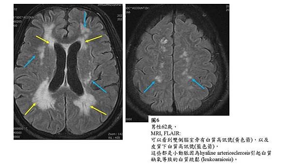 投影片6.JPG