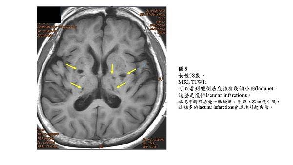 投影片5.JPG