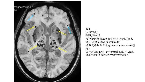 投影片4.JPG