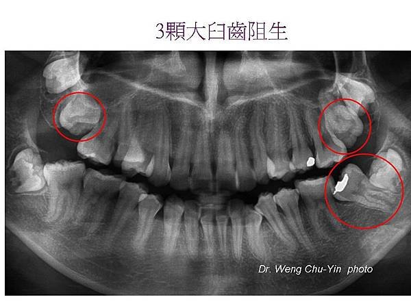 投影片2