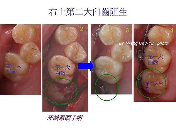 投影片3