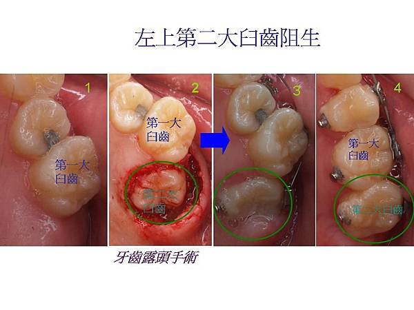 投影片4