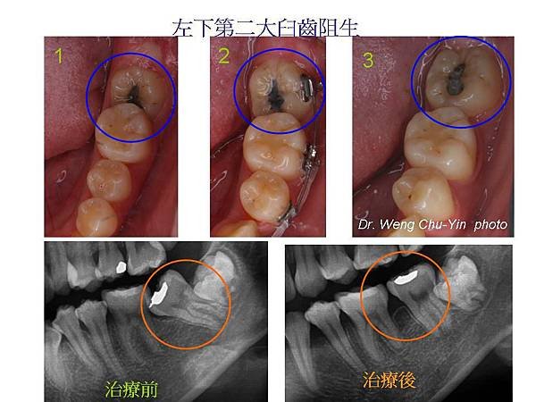 投影片5