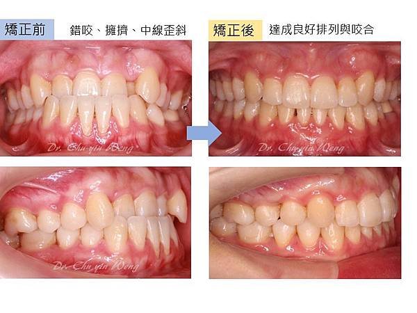 投影片3.JPG