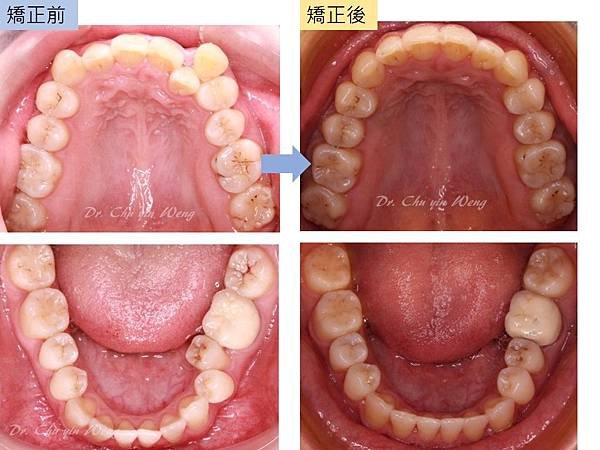 投影片4.JPG