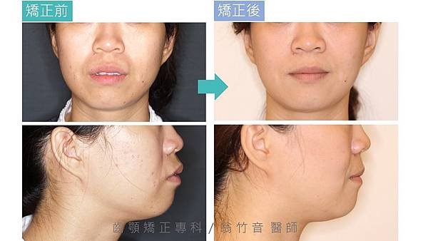 投影片3.JPG