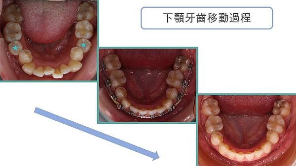 投影片5.JPG