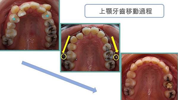 投影片4.JPG