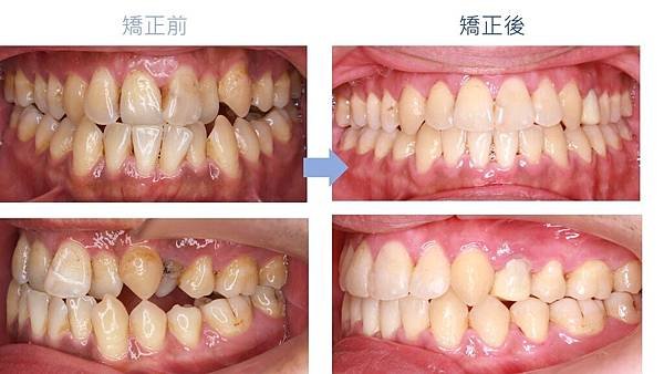 投影片5.JPG