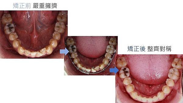 投影片3.JPG