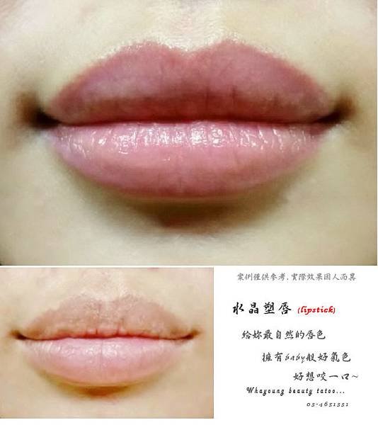 lip102.jpg