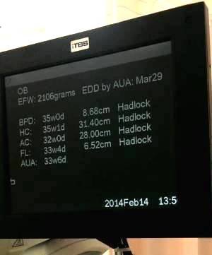 1392439494370