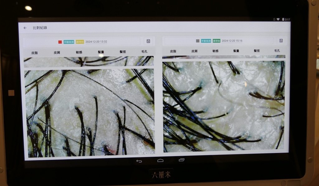 【頭皮♥保養】台北頭皮養護推薦｜頂級育髮、植髮保養、孕婦保養