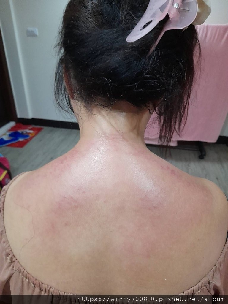 台中/北區【張老師傳統整復推拿】按摩師有20餘年專業深厚的手