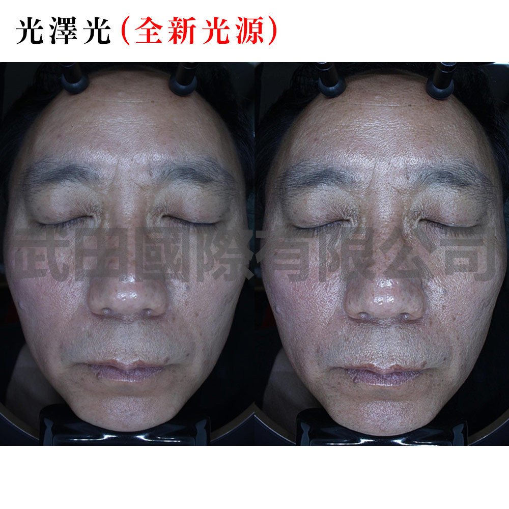 Mark-vu皮膚專業檢測儀-6-mark光澤光(全新光源).jpg