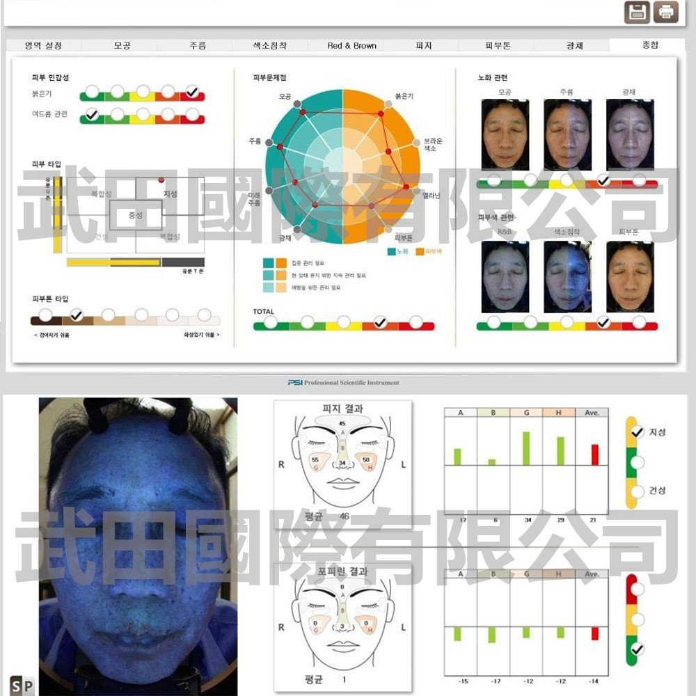 Mark-vu皮膚專業檢測儀-8-mark圖表.jpg
