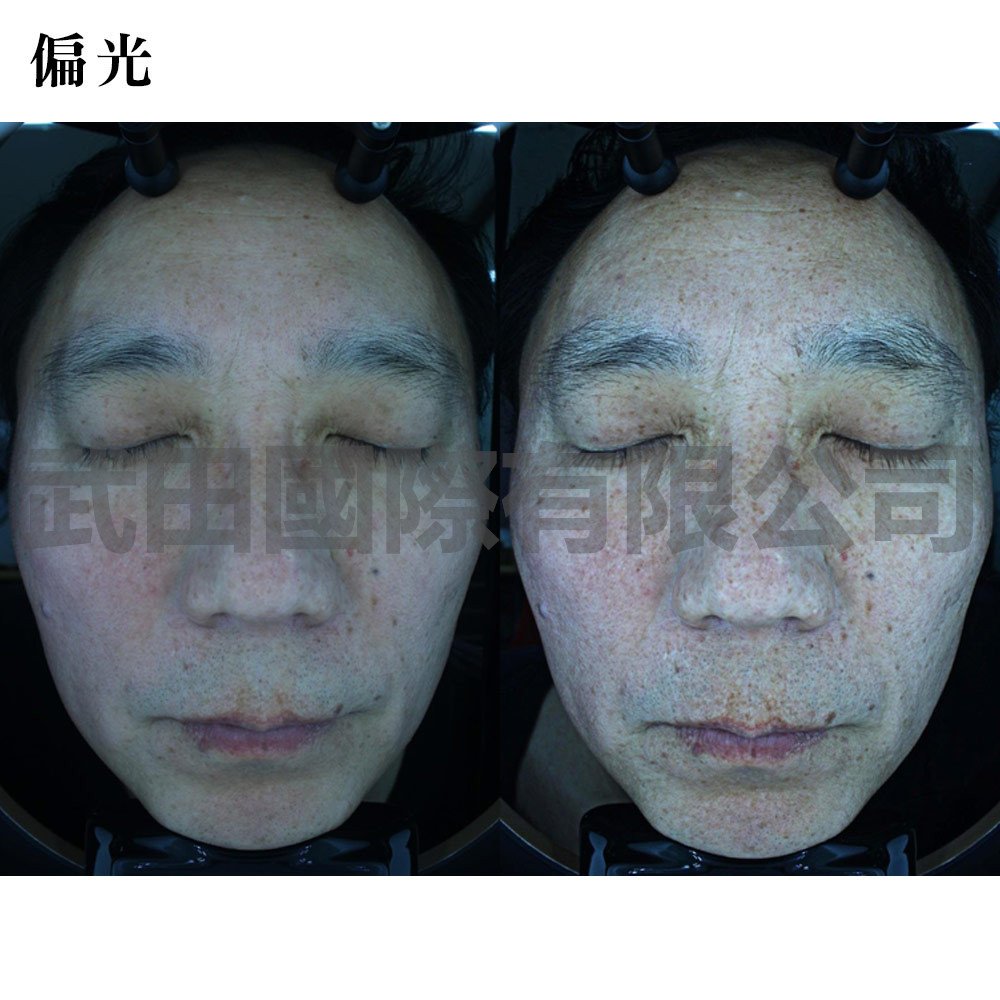 Mark-vu皮膚專業檢測儀-7-mark偏光.jpg