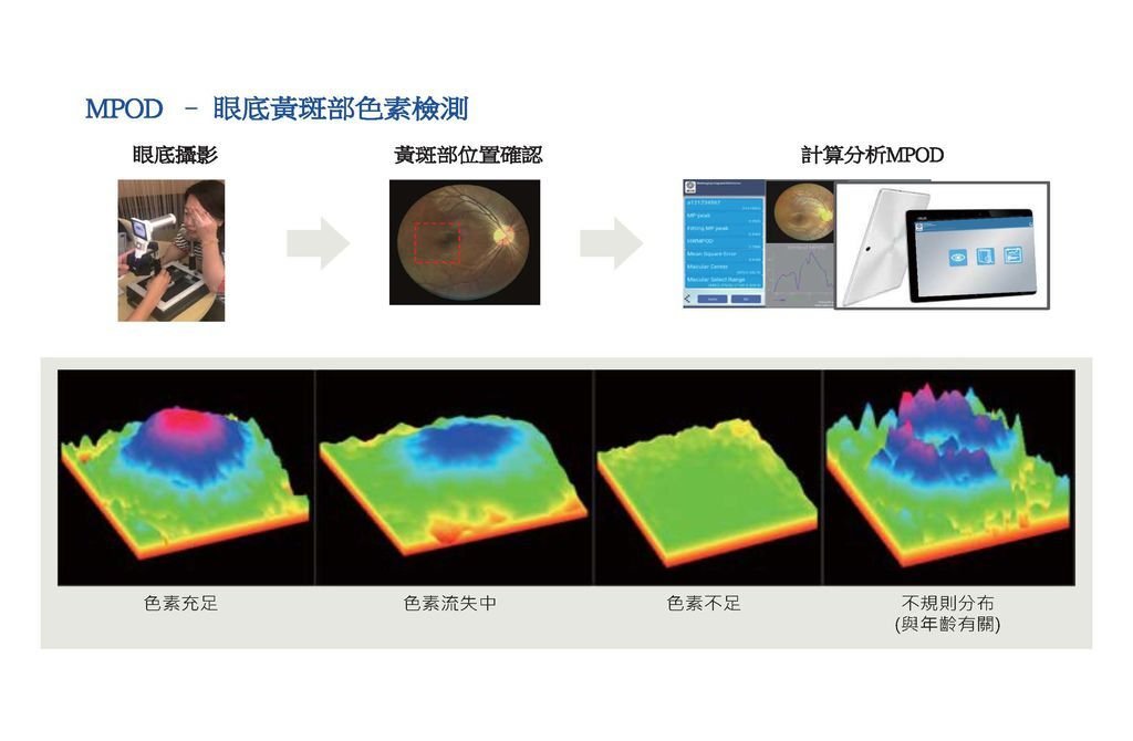 DEC200 眼底攝影機(人體葉黃素及黃斑部病變檢測儀)-3.jpg