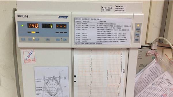 宮縮與胎動試驗