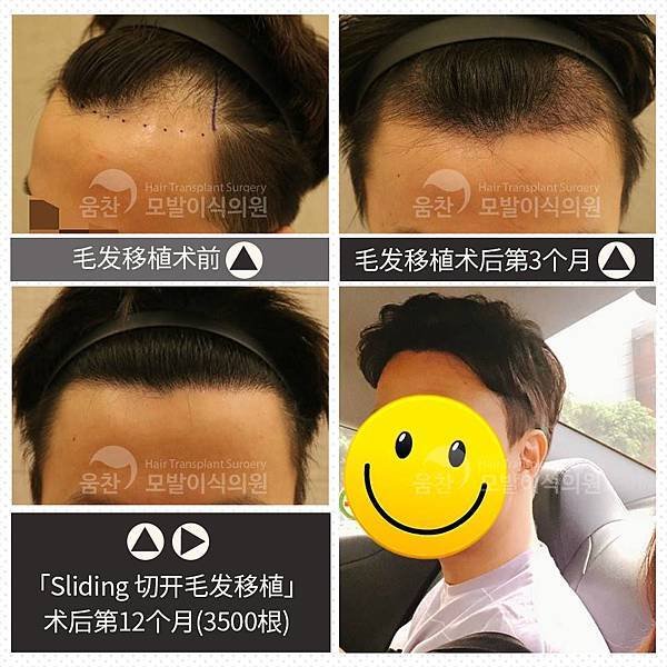 KakaoTalk_20180810_175610521.jpg
