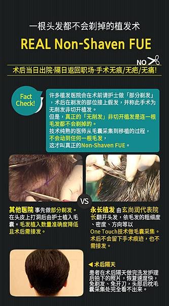 每家醫院的「免剃髮FUE」都一樣嗎? 永長「免剃髮非切式植髮