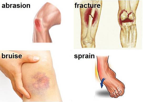 160502【MEDICINE 醫學】：injury 受傷