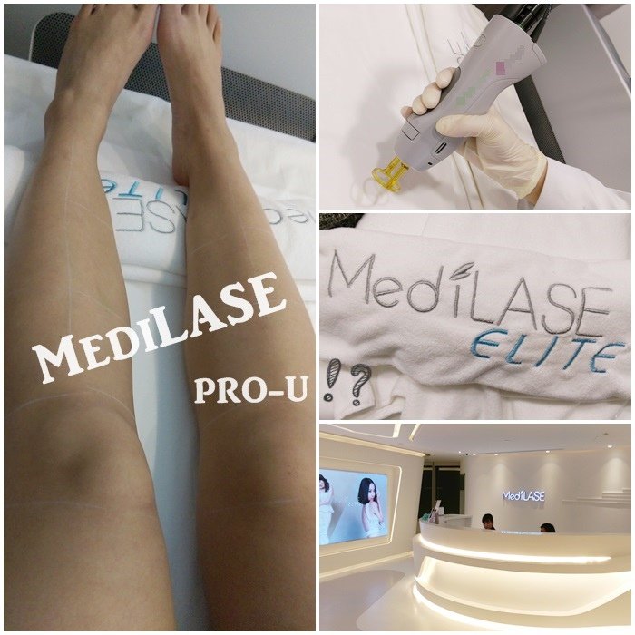 Medilase