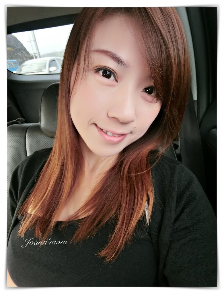 極緻醫美 縫雙眼皮CIMG0954-071.JPG