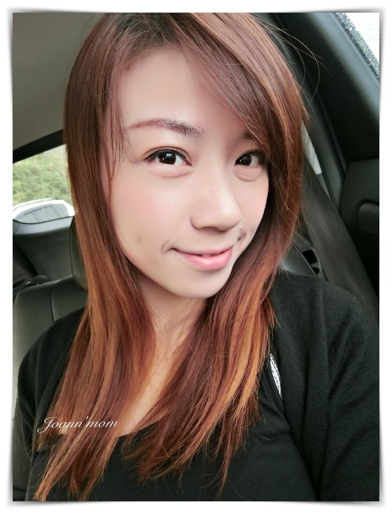 極緻醫美 縫雙眼皮CIMG0955-072.JPG