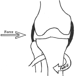 knee ligment.gif
