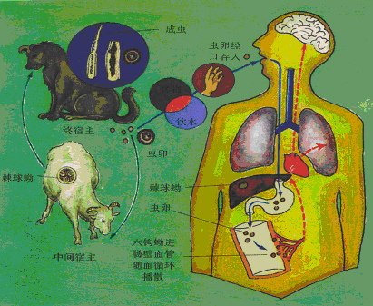 06、包蟲病﹝Echnococcosis﹞：.jpg