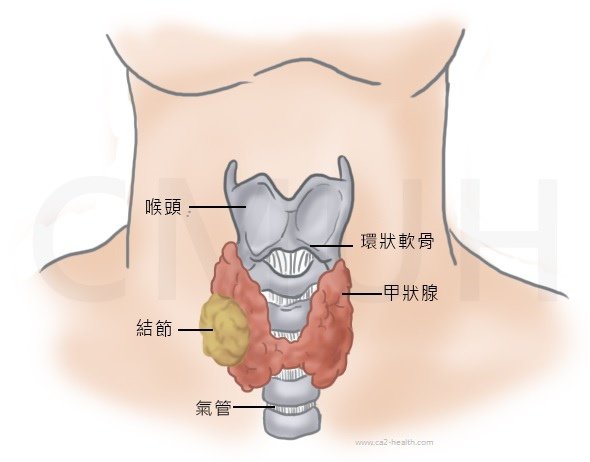 甲狀腺03